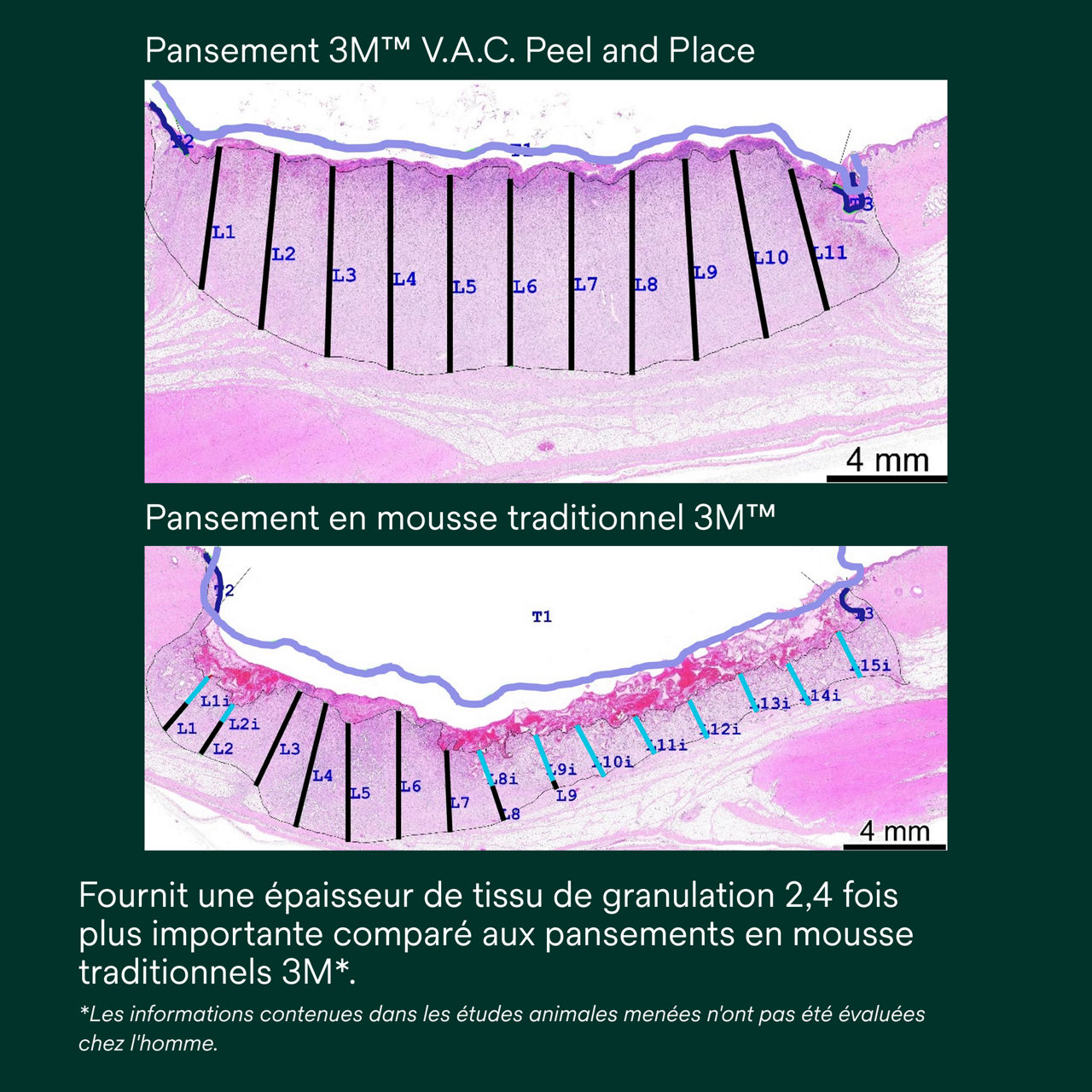 5 : V.A.C. Peel and Place - Facile à appliquer en moins de 2 minutes