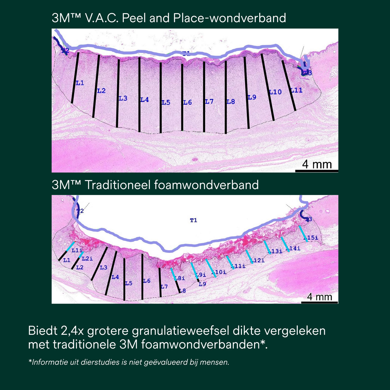 5: V.A.C. Peel and Place - Gemakkelijk aan te brengen in minder dan 2 minuten