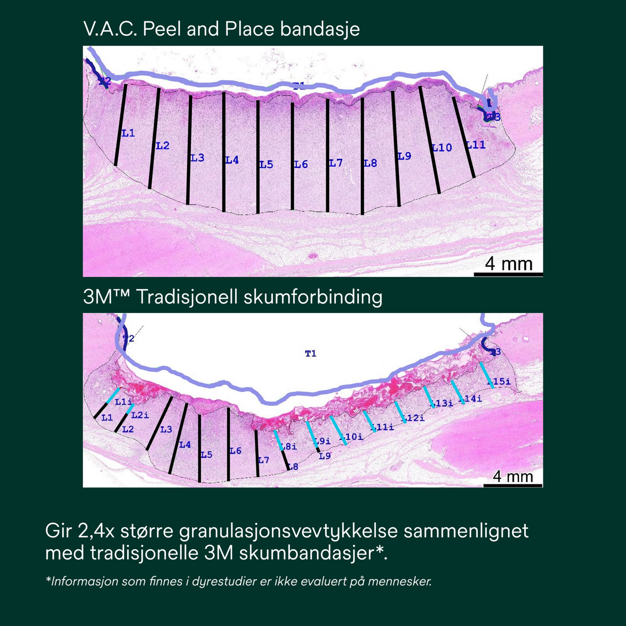5: V.A.C. Peel and Place – Enkel å påføre på mindre enn 2 minutter