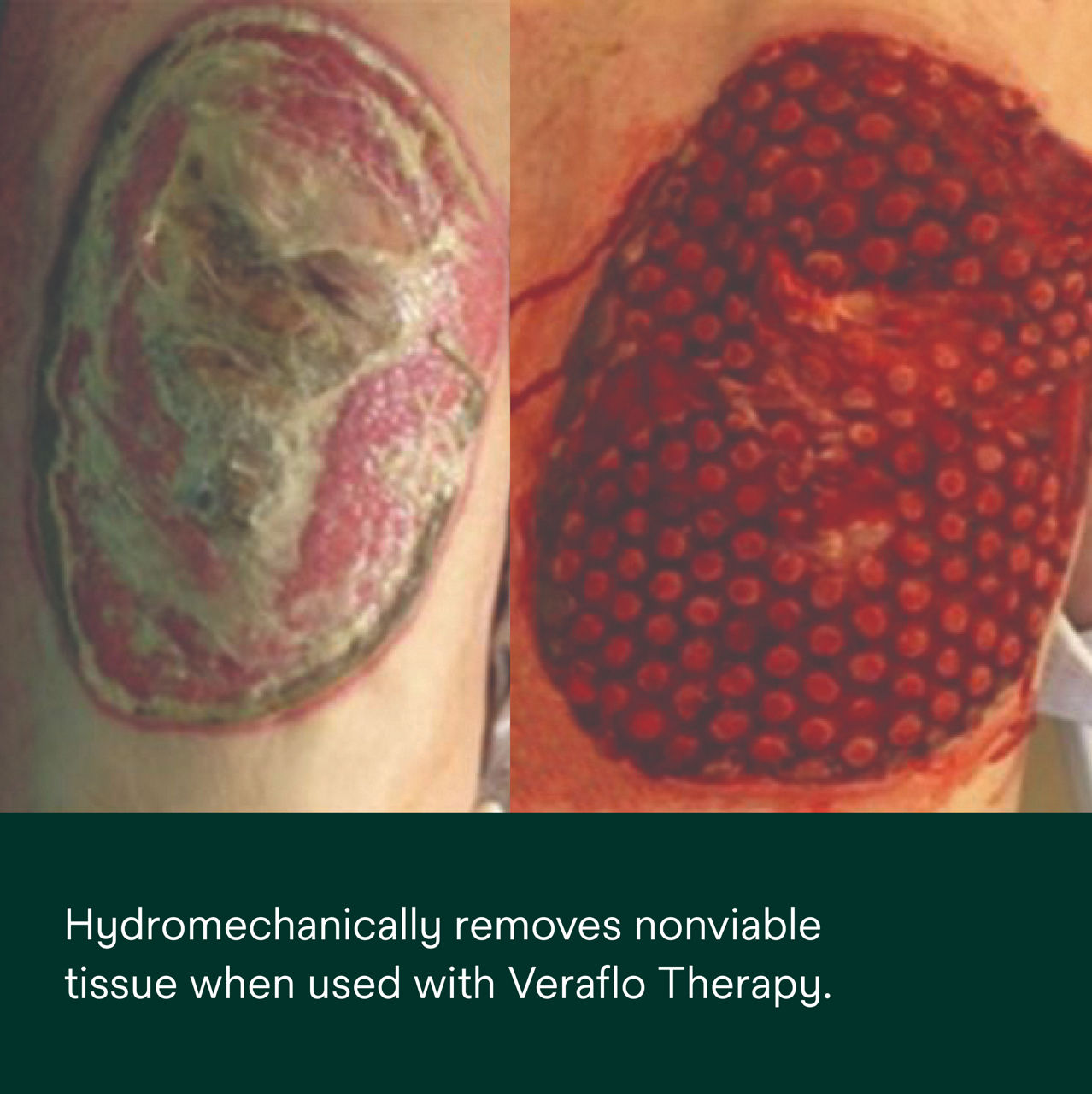 Veraflo Cleanse Choice Complete PDP Secondary Image 5