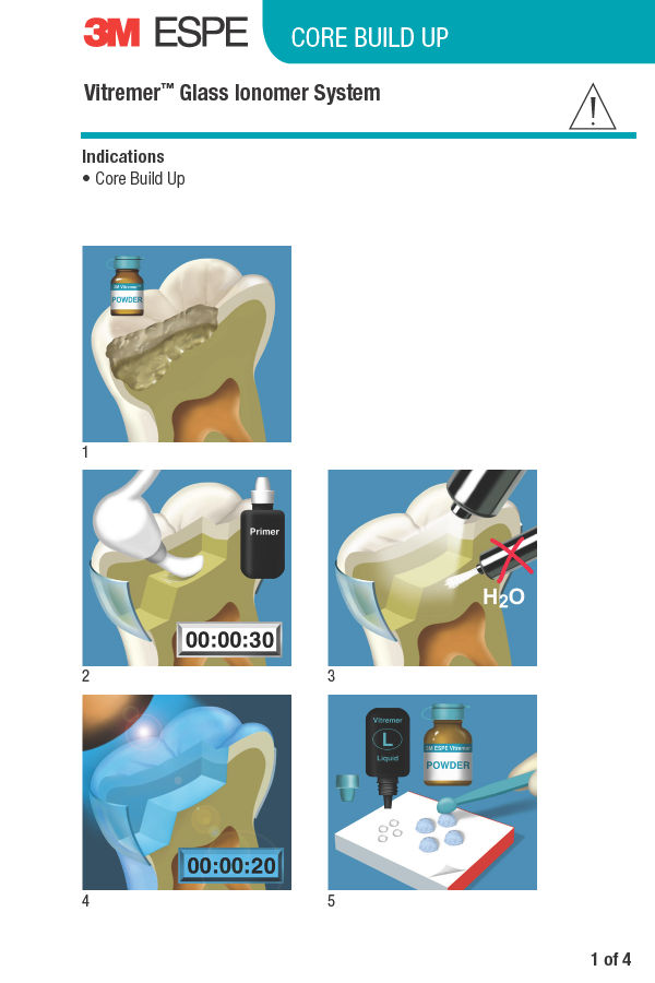Vitremer™ Glass Ionomer System