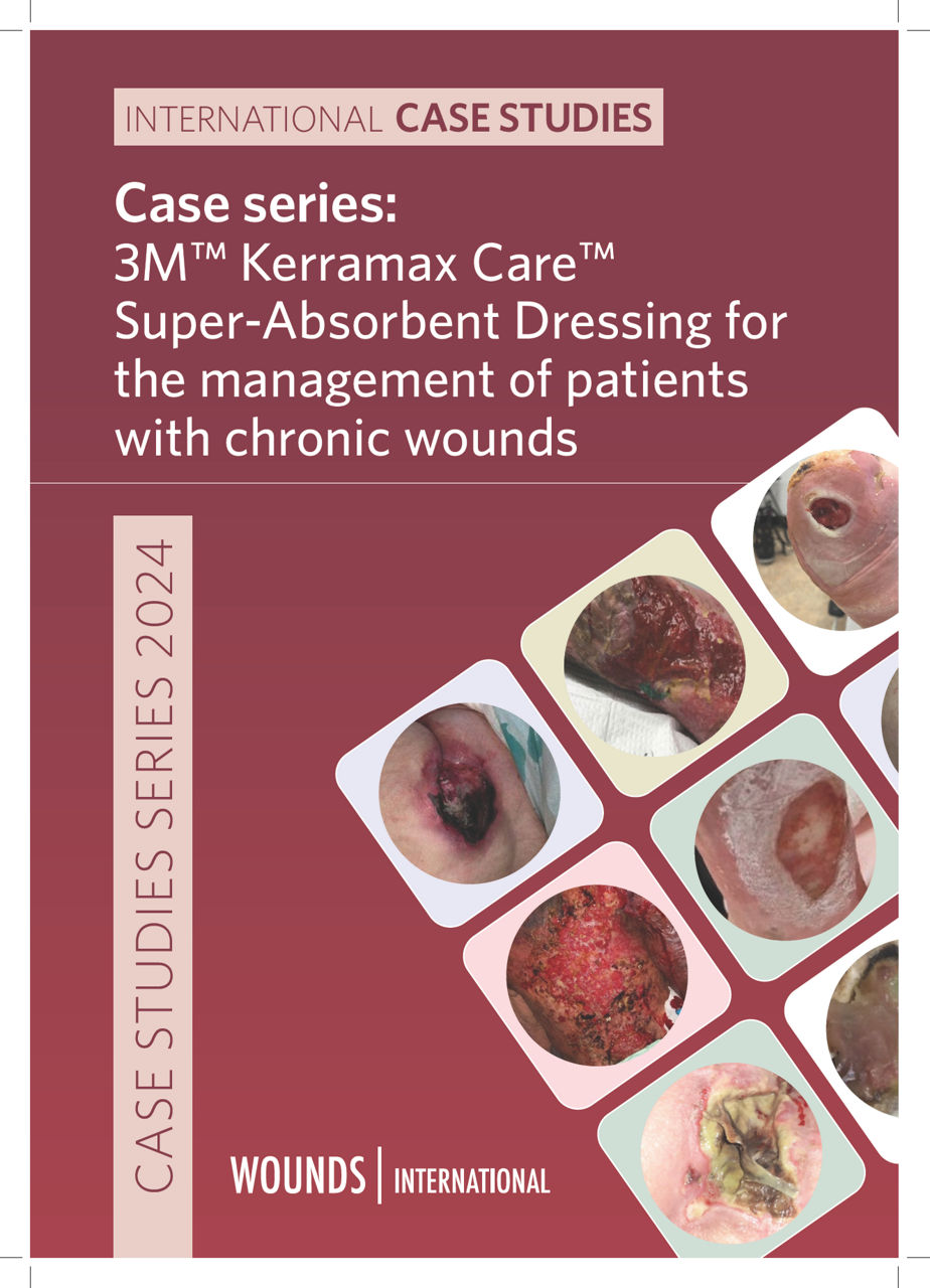 WINT Case series: 3M™ Kerramax Care™ for management of patients w/chronic wounds - EN