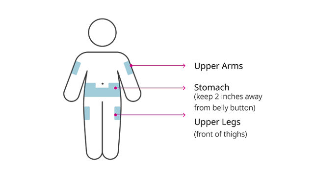 Injection sites: upper arms, stomach, upper legs