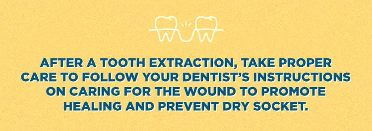 after a tooth extraction, take proper care