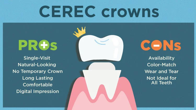 Pros and Cons of CEREC crowns