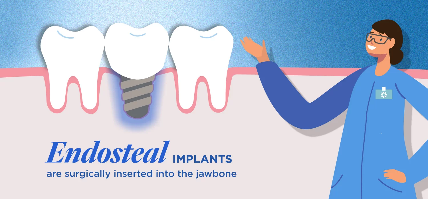 a visual explanation of what a endosteal dental implant is