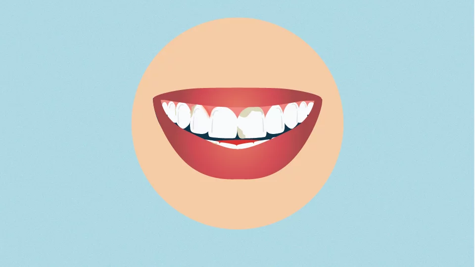 A smile that is deep cleaned