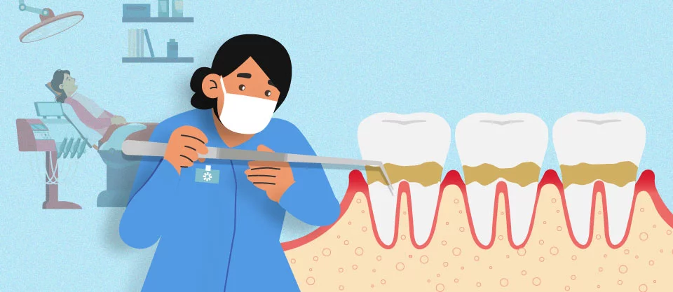 Dentist using a scaler on patient