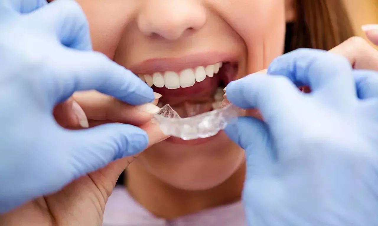 Teen putting in Clear Aligner
