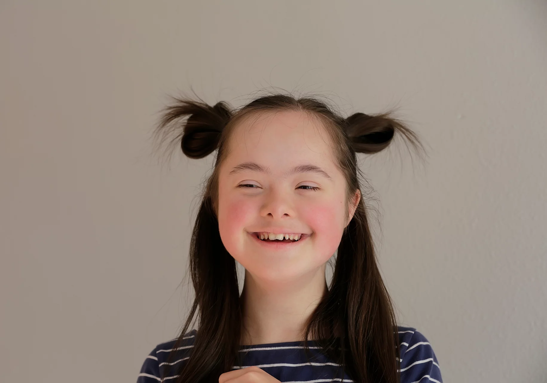 Cute smiling down syndrome girl on the grey background