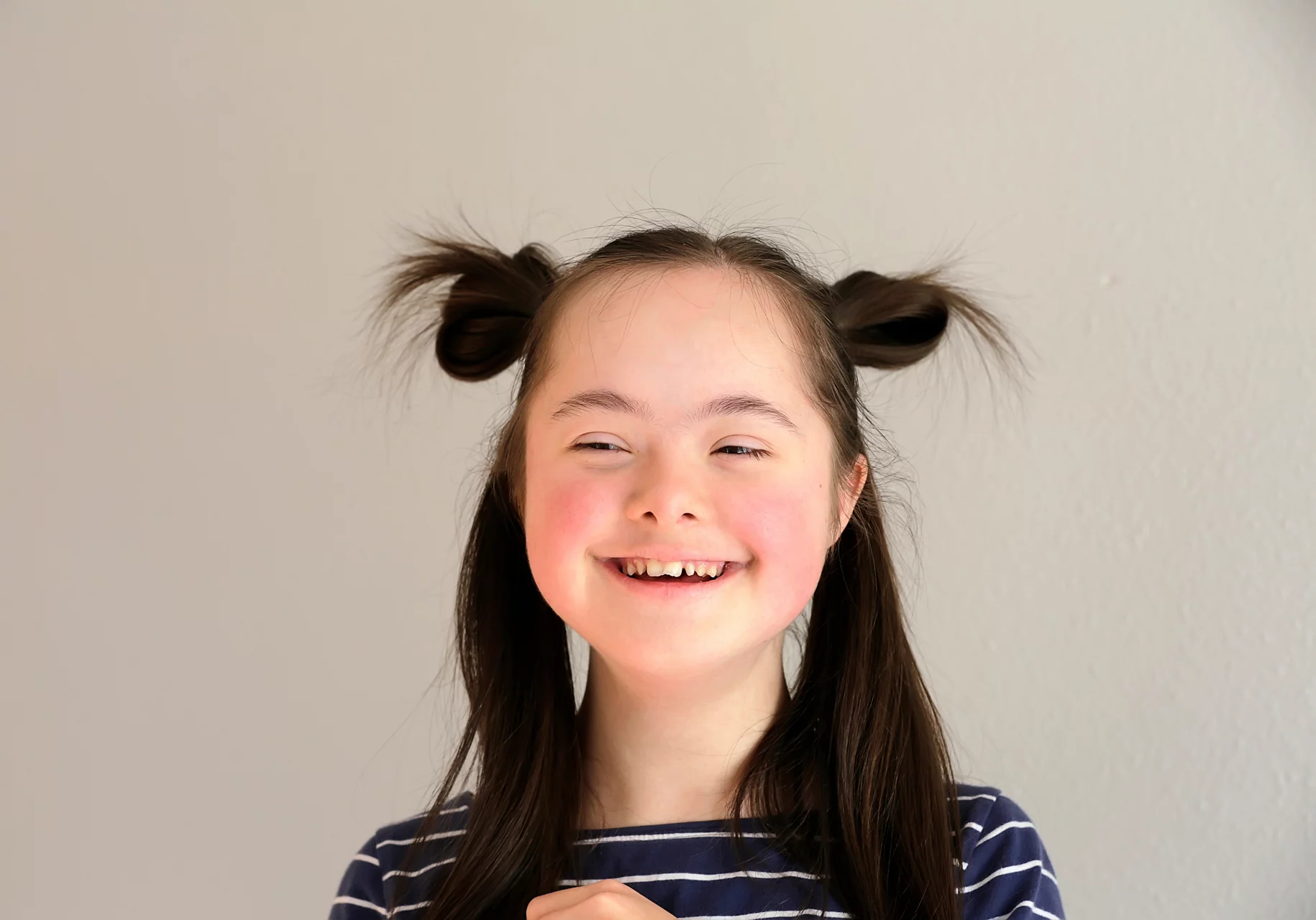 Cute smiling down syndrome girl on the grey background