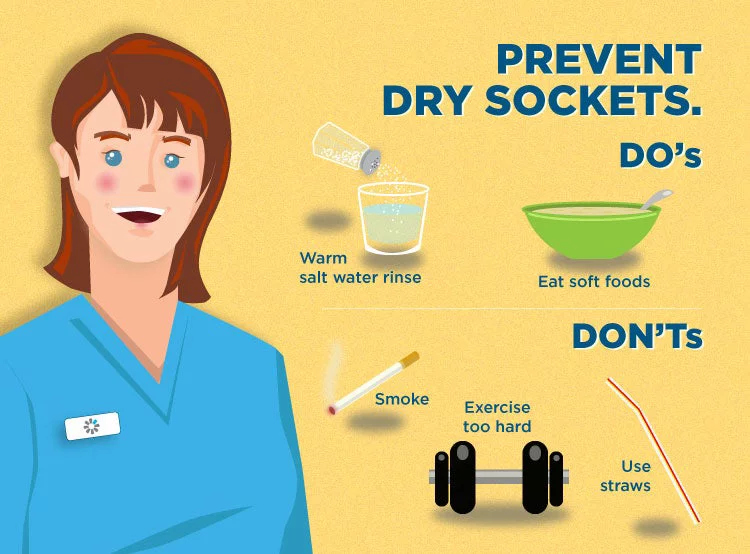 DRY SOCKET – Symptoms, treatment and causes of INFECTED tooth extraction