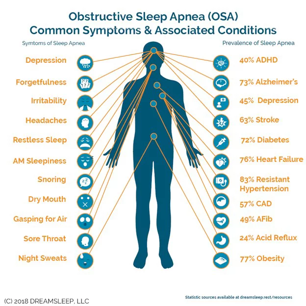Obstructive sleep apnea