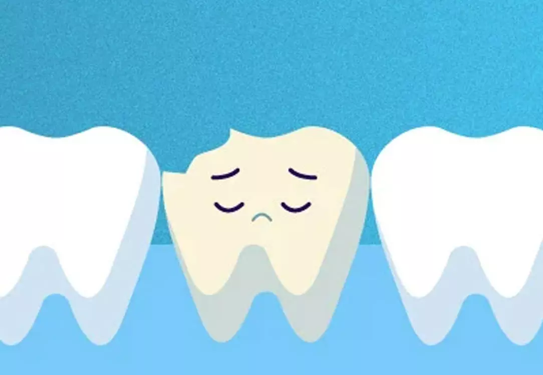 Dental Update - Technique tips: moisture control in children