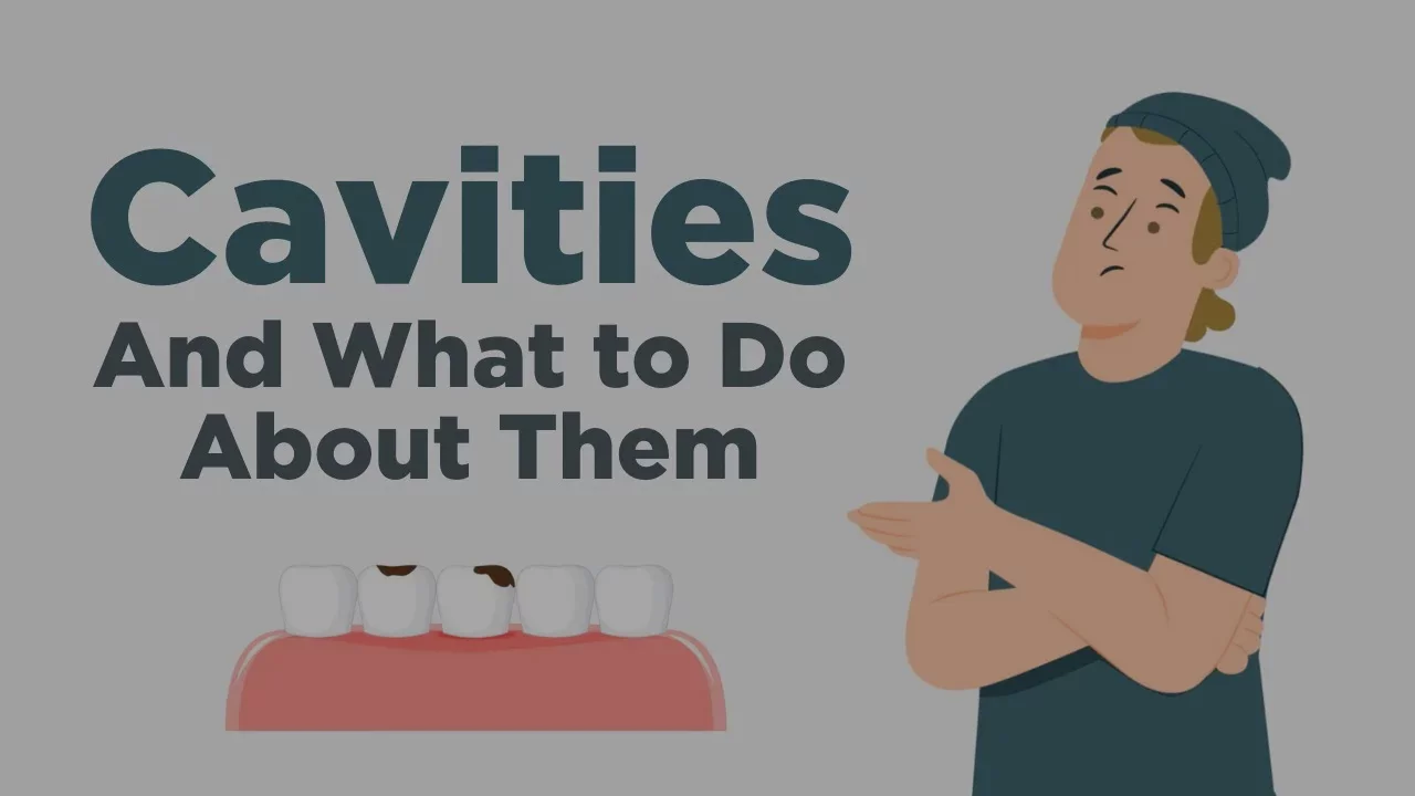 Cavities - Everything You Need to Know