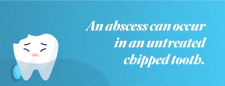A tooth in pain. An abscess can occur in an untreated chipped tooth