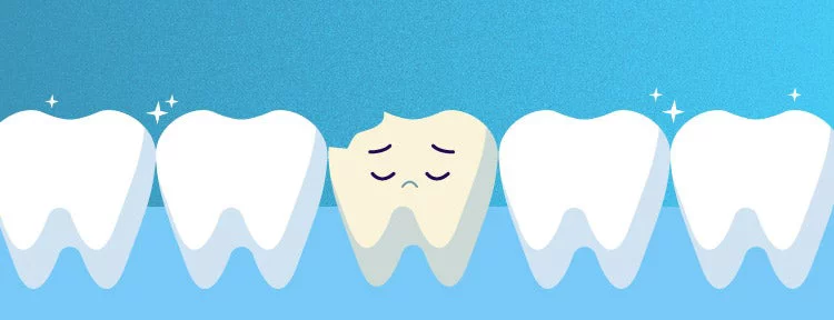 unhappy tooth among a row of sparkly teeth