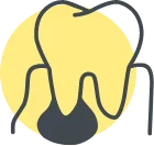 a tooth with abscess inside a yellow circle.
