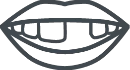 black and white missing tooth smile