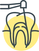Root Canal