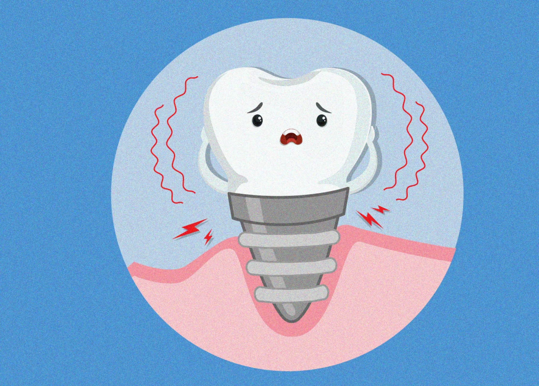 a dental implant in a lot of pain