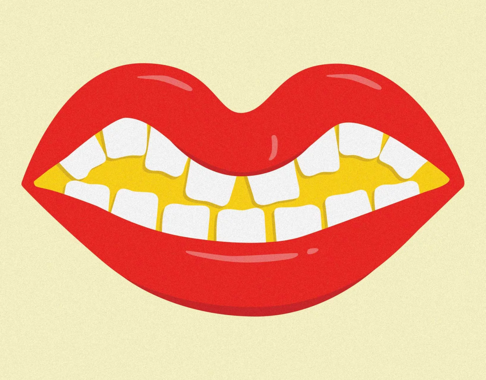 Open mouth with crooked teeth