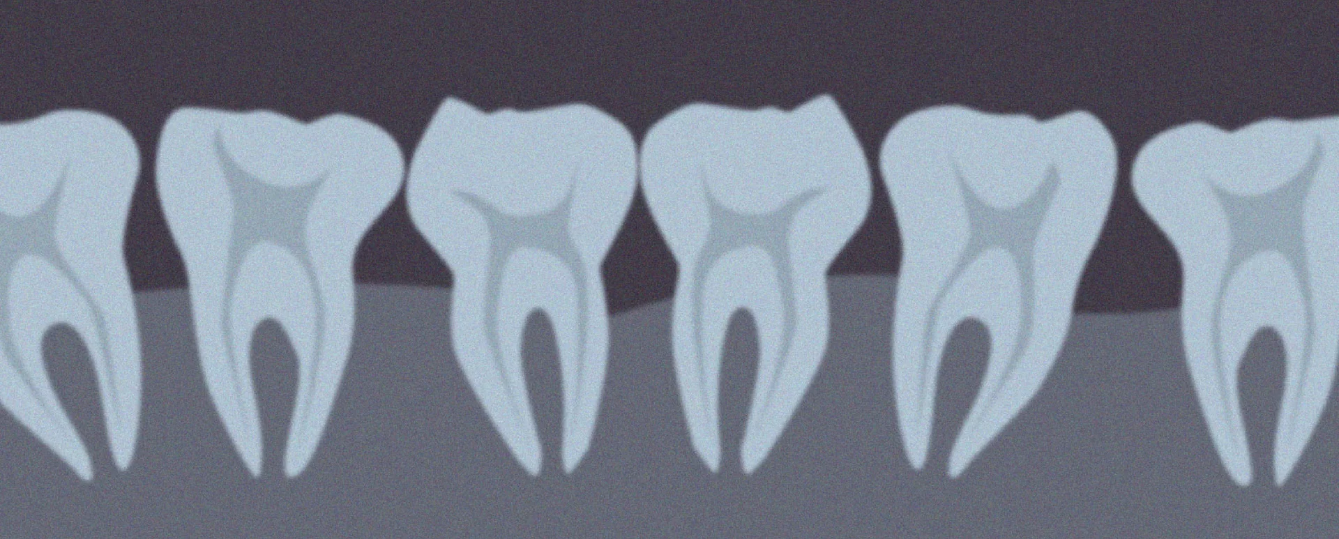 Up close x-ray of teeth