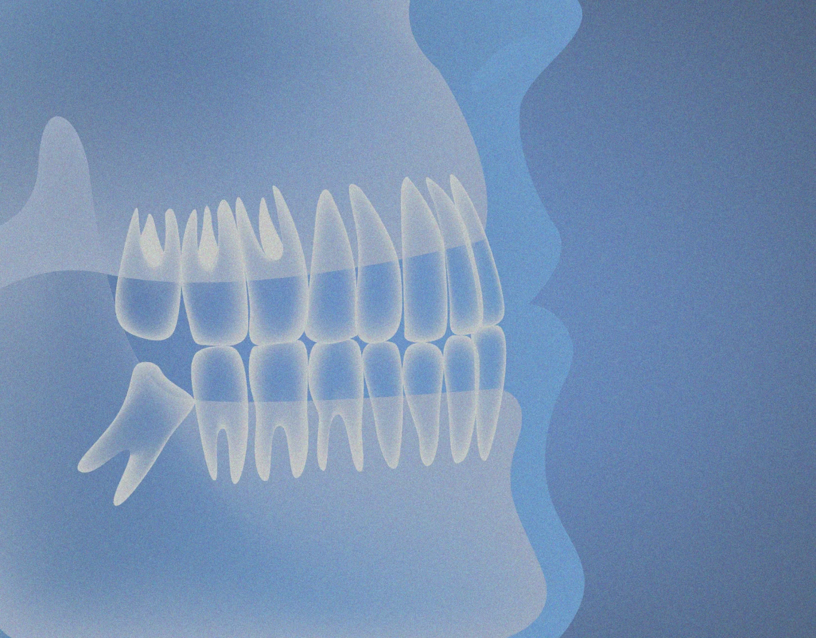 X-ray of teeth and jaw