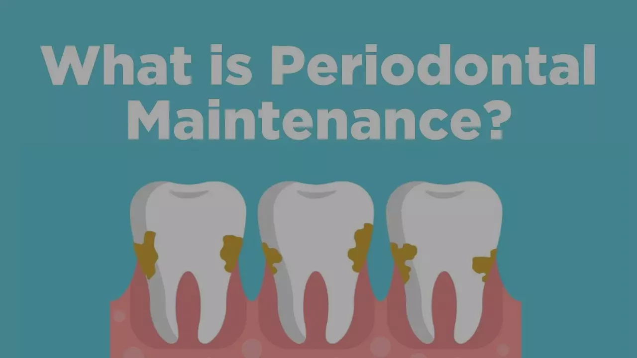 Periodontal Maintenance - What is it?