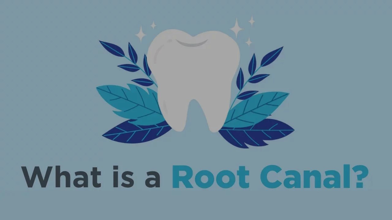 Root Canals - Everything You Need to Know