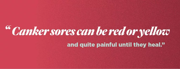 canker sores can be red or yellow and quite painful until they heal