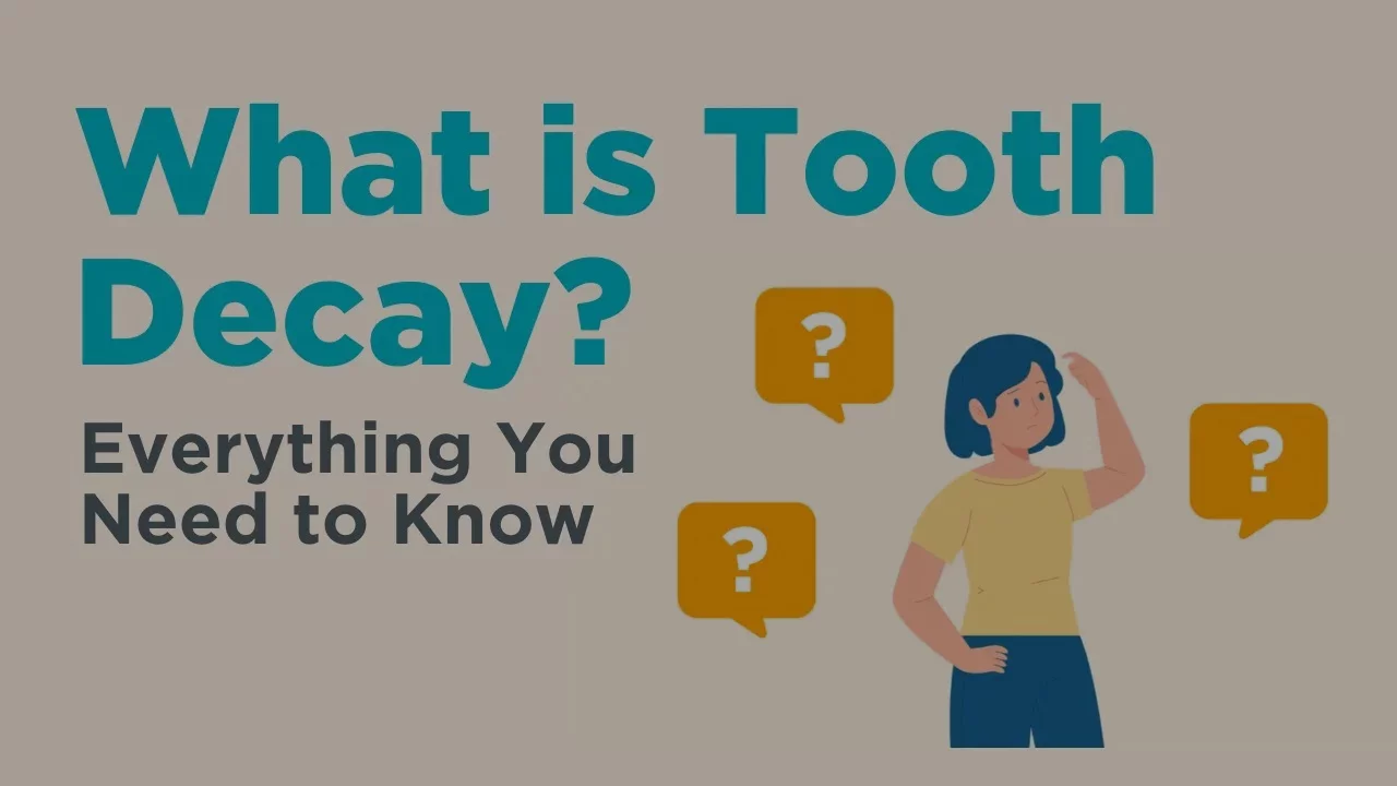 What is tooth decay?