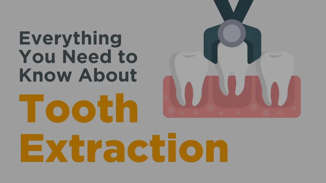 Tooth Extractions - Everything You Need to Know