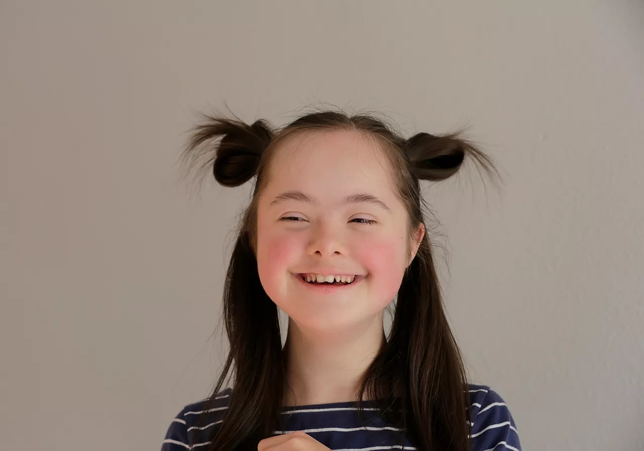 Cute smiling down syndrome girl on the grey background