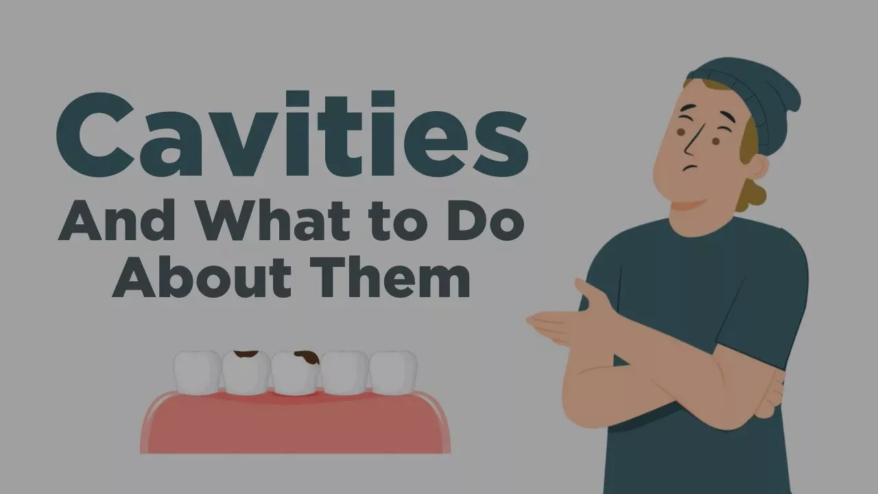 Cavities - Everything You Need to Know