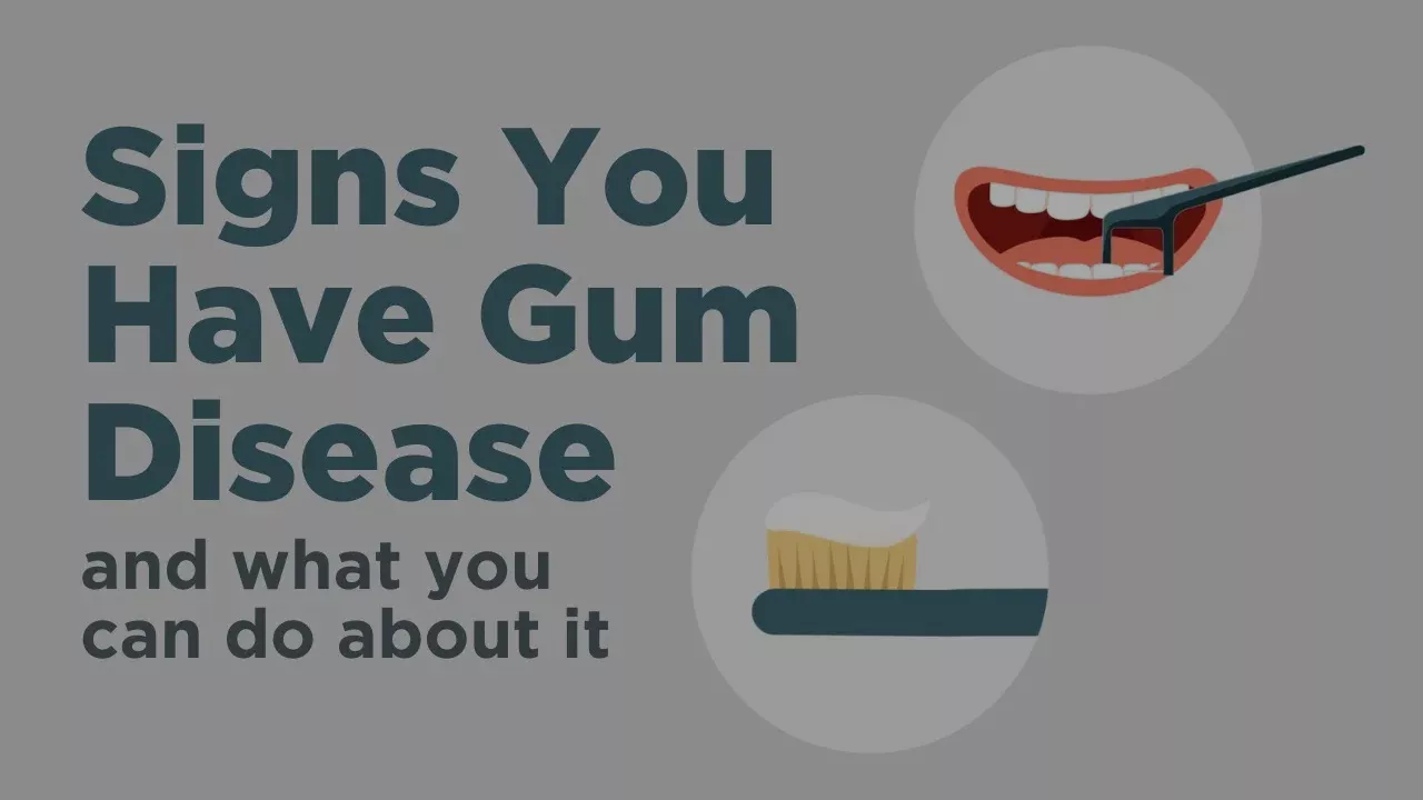 Smile Geriodontal Disease - Everything You Need to Knoweneration MyChart: Experience Overview (Web Browser) 