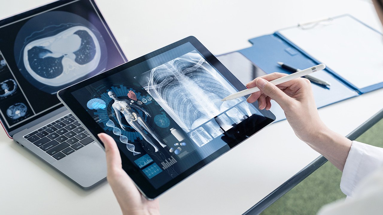 A doctor reviews an imaging scan on a digital table with a laptop in the background