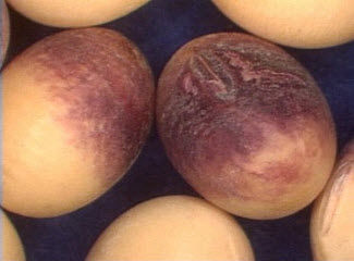 Photo showing Cercospora purple seed stain on soybean seeds.