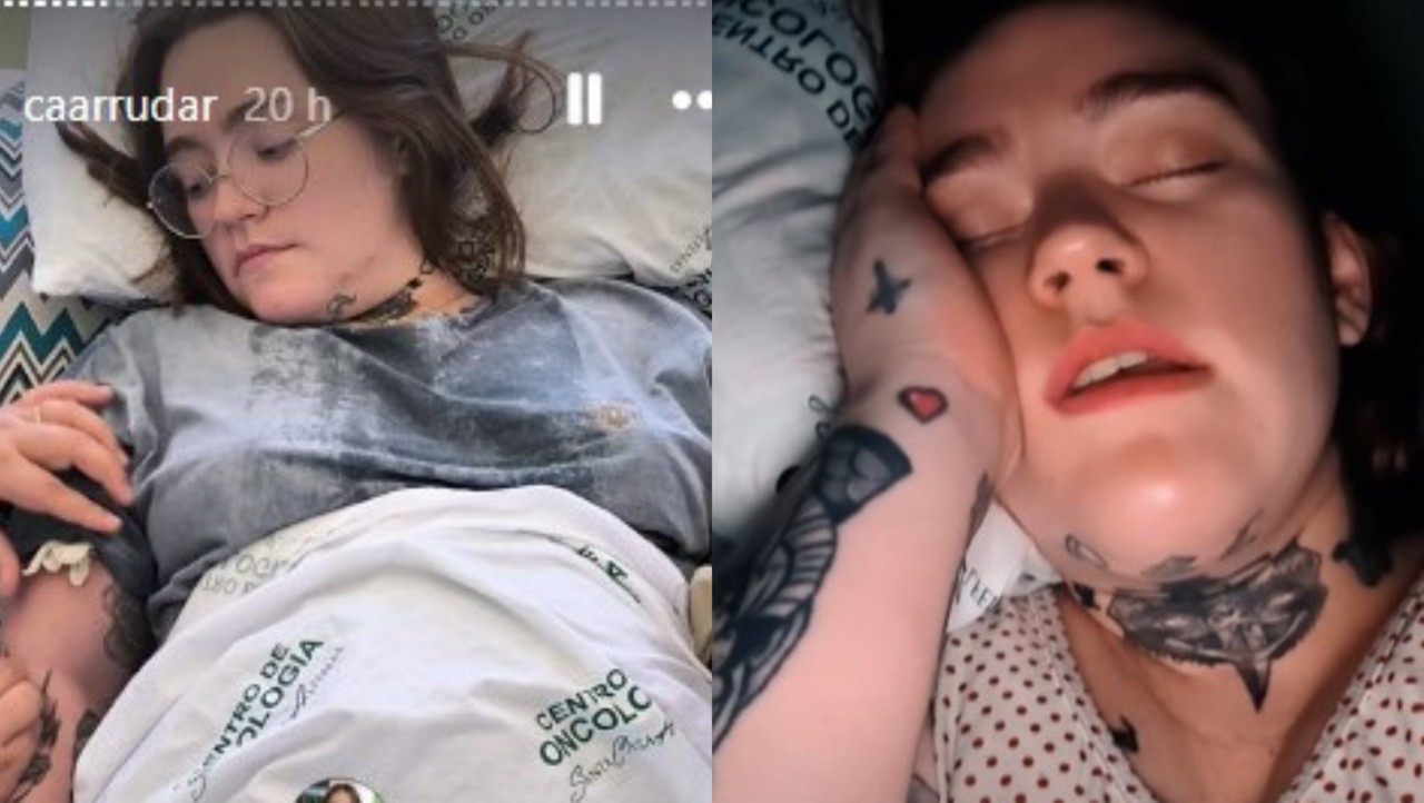 Carolina Arruda, de 27 anos, vive há 11 anos com neuralgia do trigêmeo