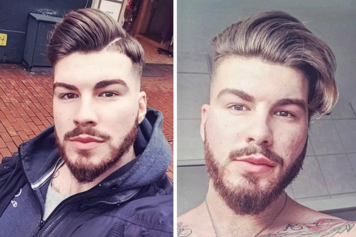 Influencer adepto a modificações corporais extremas mostra rosto antes de tatuagens