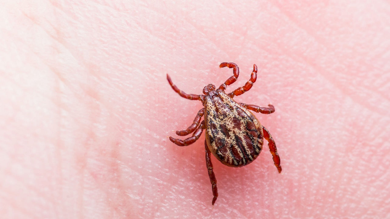 A tick is sitting on a person's hand.