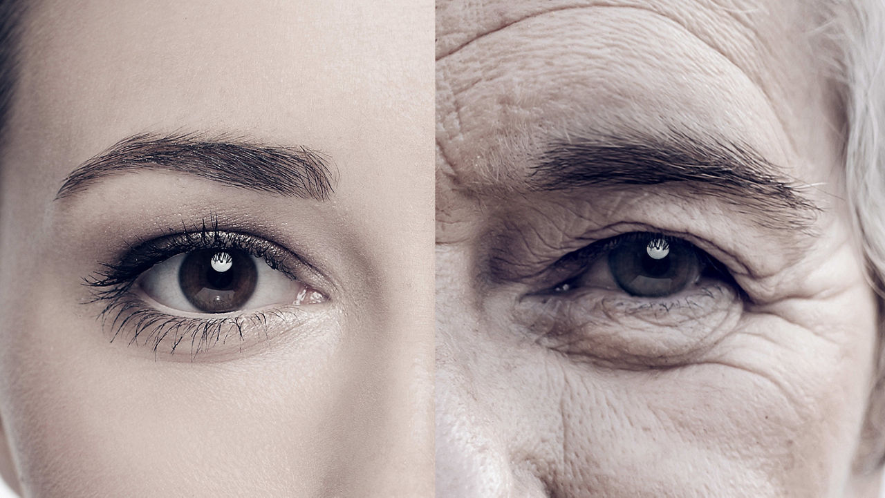 A woman's face before and after a procedure.