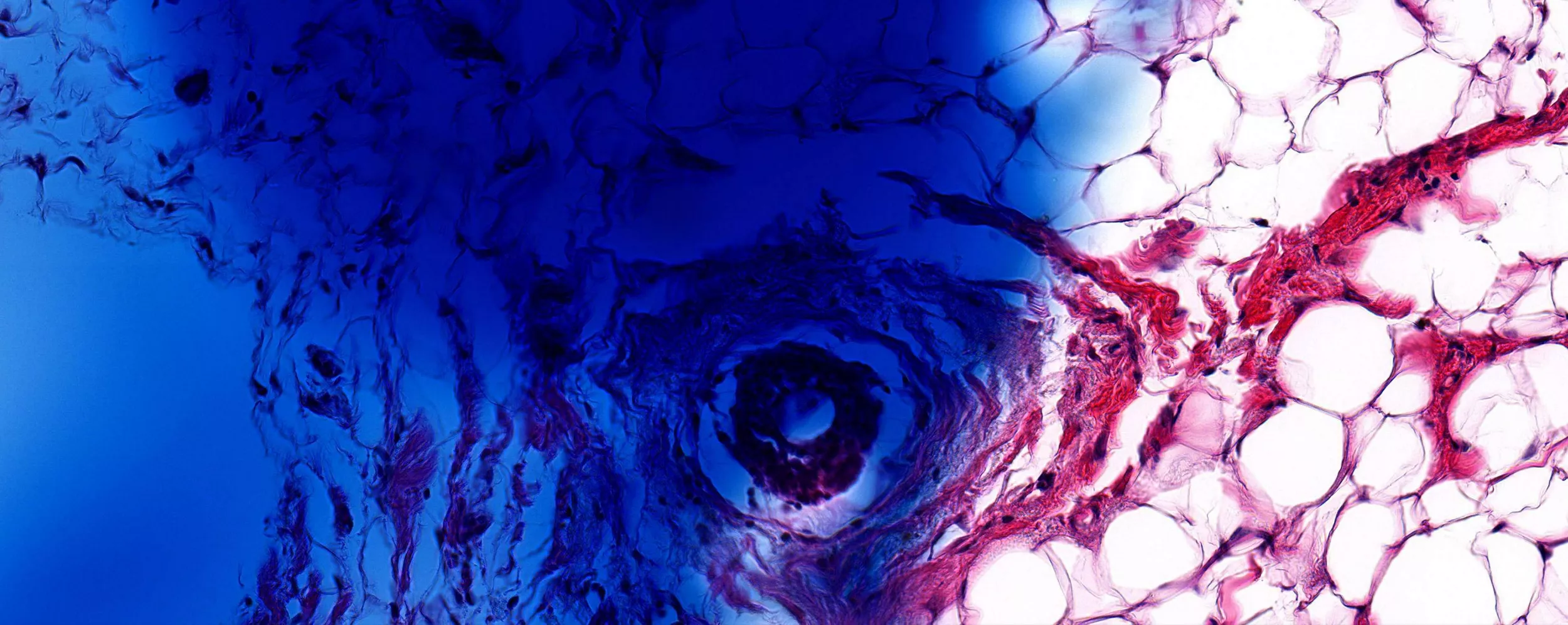 A closeup image of a cancer cell.
