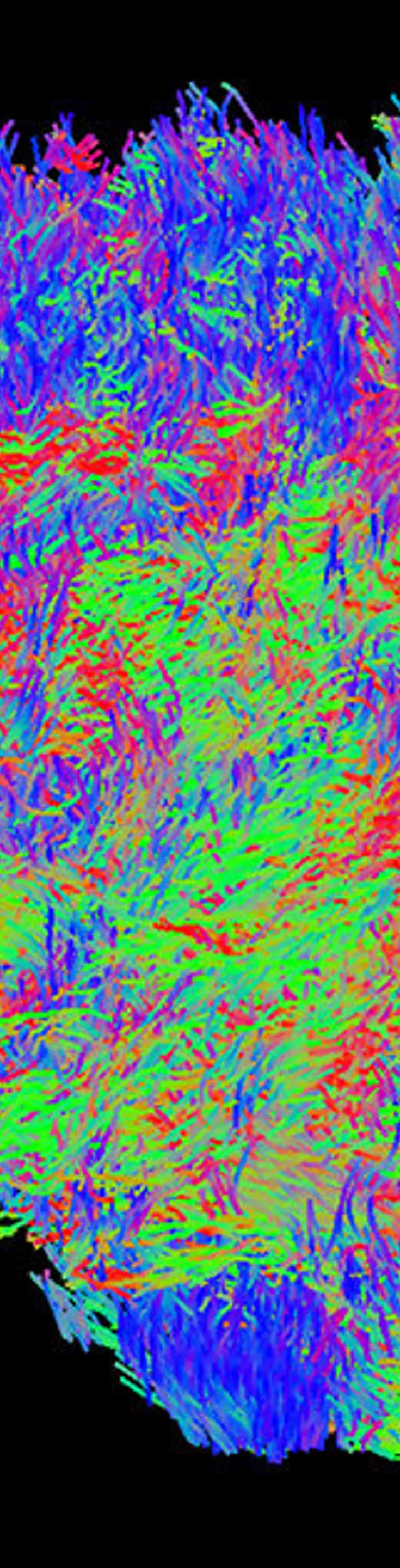 A vibrant visualization of brain fiber pathways is displayed against a solid black background. The image uses red, green, and blue lines to represent neural tracts, creating a detailed and intricate map of brain connectivity. No visible text, numbers, or identifiable brands are present. The overall effect is scientific and visually striking, emphasizing the complexity of neural networks.