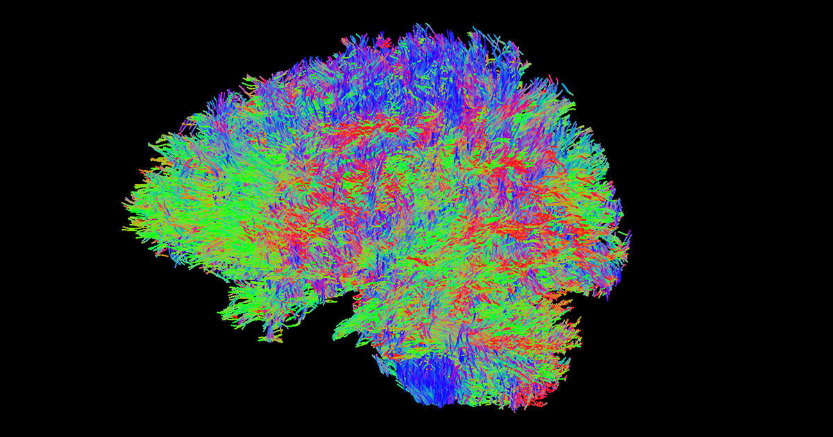 A vibrant visualization of brain fiber pathways is displayed against a solid black background. The image uses red, green, and blue lines to represent neural tracts, creating a detailed and intricate map of brain connectivity. No visible text, numbers, or identifiable brands are present. The overall effect is scientific and visually striking, emphasizing the complexity of neural networks.