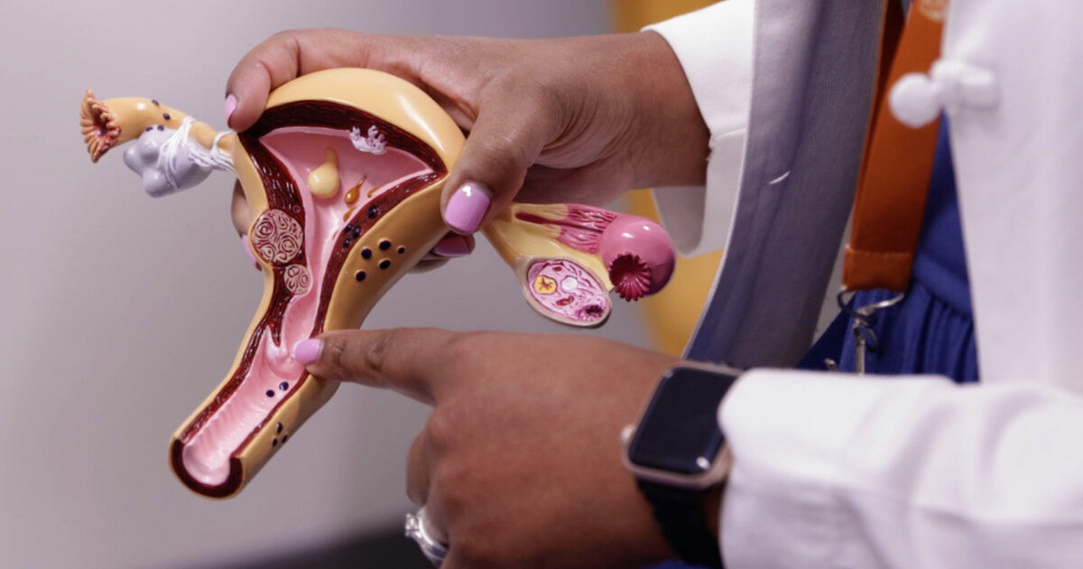 A person in a white coat holds and points to a detailed anatomical model of the female reproductive system. The setting appears clinical or educational, with the model showing internal organs and possible medical conditions. The individual wears a smartwatch and an ID badge, suggesting a healthcare or teaching environment. The focus is on the anatomical features and the demonstration process.