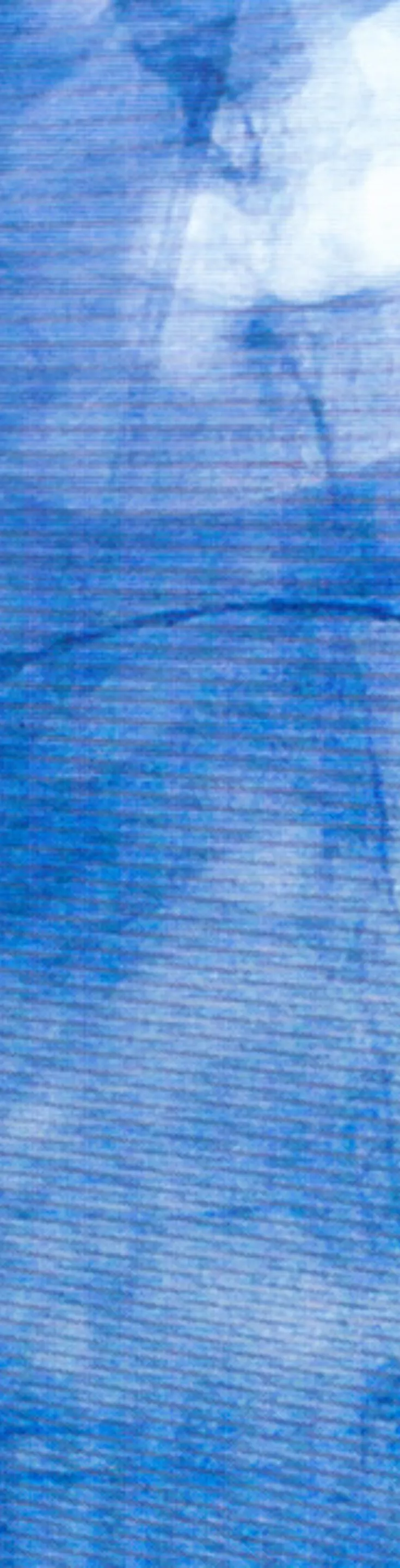 This image displays a medical X-ray with a visible catheter inserted into a patient's body. The setting is clinical, likely during a diagnostic or interventional procedure. The visuals are dominated by blue tones and translucent anatomical structures, with the catheter forming a distinct curved line. No visible text or numeric values are present in the image.