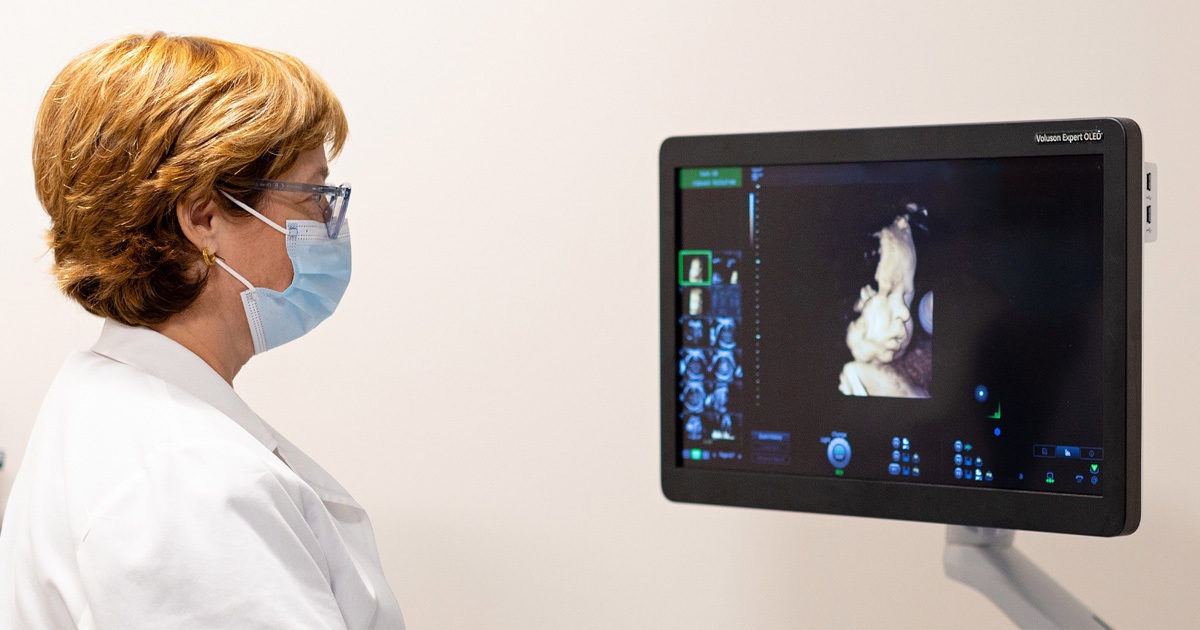 A healthcare worker with short hair and a white coat observes a high-resolution ultrasound image displayed on a medical monitor. The setting appears to be a clinical examination room with neutral walls. The monitor shows a detailed fetal scan, with various interface elements and controls visible. The scene conveys a professional, clinical atmosphere with a focus on prenatal care technology.