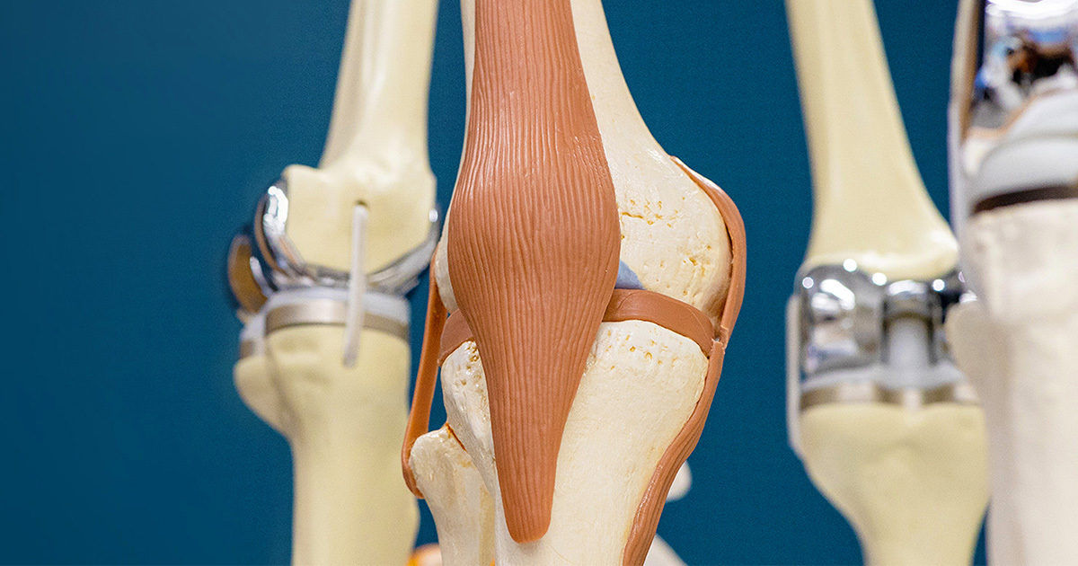 This image shows a close-up view of a human knee joint anatomical model. The model highlights the bones, ligaments, and tendons, with a focus on the patella and surrounding structures. The background includes additional joint models, emphasizing a medical or educational setting. No visible text or numeric values are present in the image.