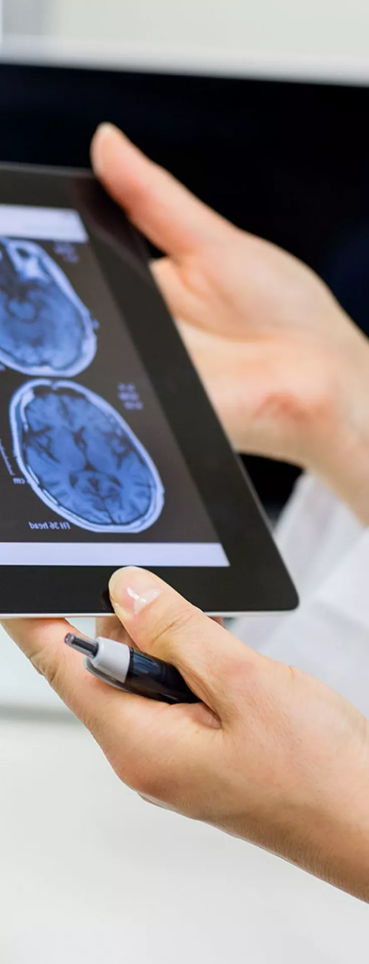 Two medical professionals examine a digital tablet displaying multiple brain scan images. The setting appears to be a clinical or hospital environment, with a focus on diagnostic activity. 